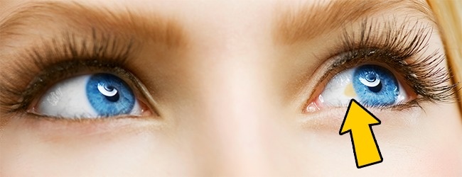 12 вещей связанных со здоровьем о которых вам расскажут глаза